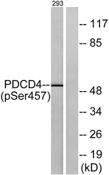 Pdcd-4 (phospho Ser457) rabbit pAb