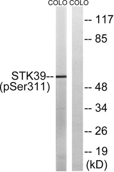 SPAK (phospho Ser309) rabbit pAb