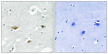 SPAK (phospho-Ser325) antibody