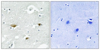 SPAK (phospho Ser323) rabbit pAb
