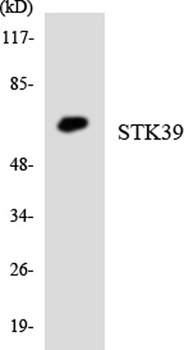 SPAK antibody