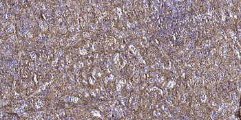 G alpha t2 antibody