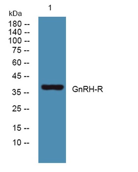 GnRH-R rabbit pAb