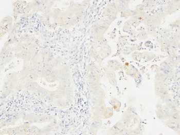 14-3-3 Sigma antibody