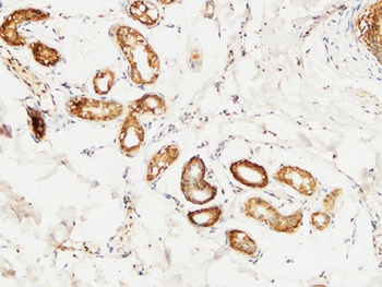 14-3-3 Sigma antibody