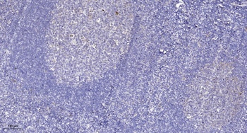 PR48 antibody