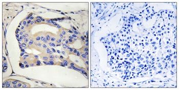 STK32C antibody