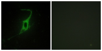 Cadherin-20 rabbit pAb
