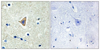 Cadherin-20 rabbit pAb