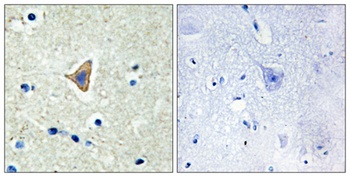 Cadherin-20 antibody