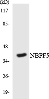 NBPF5 rabbit pAb
