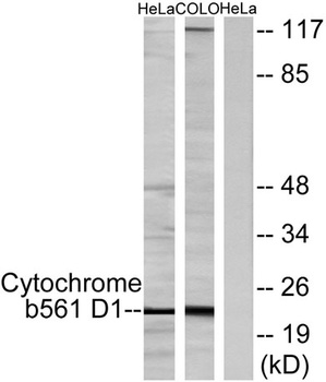 CYB561D1 rabbit pAb