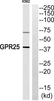 GPR25 rabbit pAb