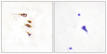 EphA6 antibody