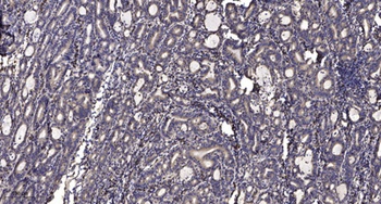 CYP4V2 rabbit pAb Antibody