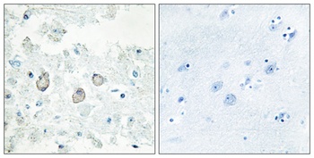 Dok-7 antibody