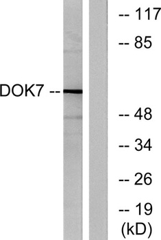 Dok-7 rabbit pAb