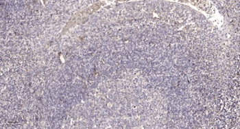 Ribosomal Protein L7L1 antibody