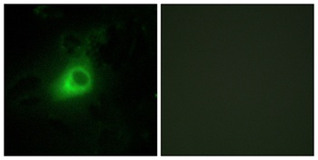 GRK 6 antibody