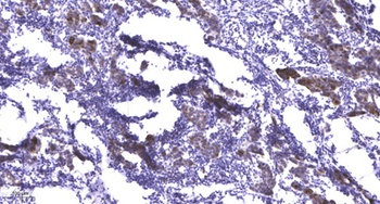 Mnk2 antibody