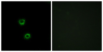 Cdc50C rabbit pAb Antibody