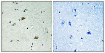 GRB10 (phospho Tyr67) rabbit pAb