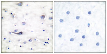 GluR-1 (phospho-Ser863) antibody