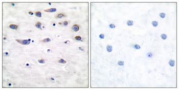 GluR-1 (phospho Ser849) rabbit pAb