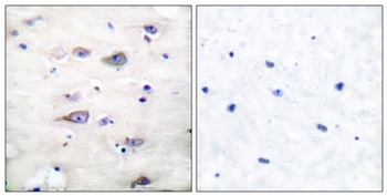 GluR-2 (phospho Ser880) rabbit pAb