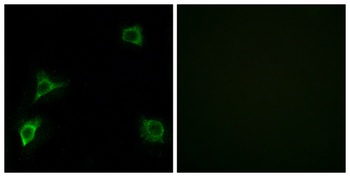 GluR-delta 2 antibody
