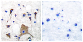 GluR-5 antibody