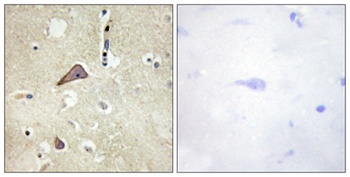 NMDAζ1 (phospho Ser896) rabbit pAb