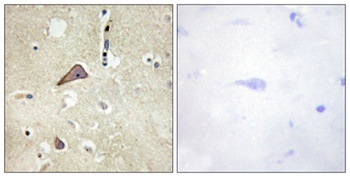 NMDAzeta 1 (phospho-Ser896) antibody