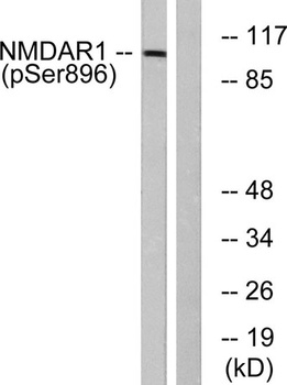 NMDAζ1 (phospho Ser896) rabbit pAb