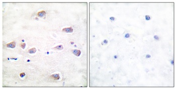 NMDAzeta 1 (phospho-Ser897) antibody