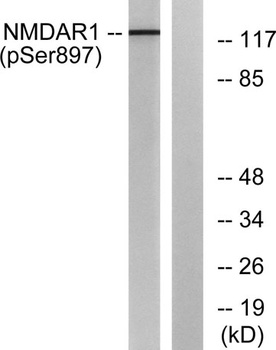 NMDAzeta 1 (phospho-Ser897) antibody