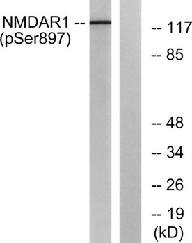 NMDAζ1 (phospho Ser897) rabbit pAb