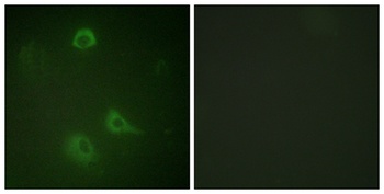 NMDAζ1 (phospho Ser890) rabbit pAb