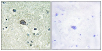 NMDAζ1 (phospho Ser890) rabbit pAb