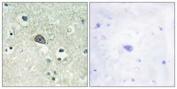 NMDAzeta 1 (phospho-Ser890) antibody