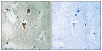 NMDAζ1 rabbit pAb