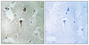 NMDA zeta 1 antibody