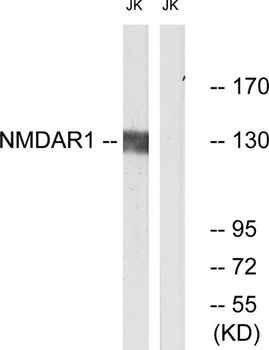 NMDAζ1 rabbit pAb