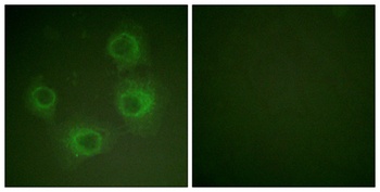 NMDAε1/2 (phospho Tyr1246/1252) rabbit pAb