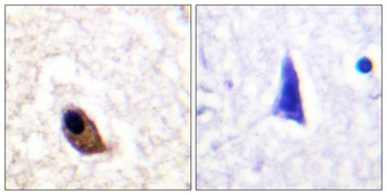 NMDA Epsilon 1/2 (phospho-Tyr1246/1252) antibody