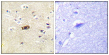 NMDA Epsilon 1/2 antibody
