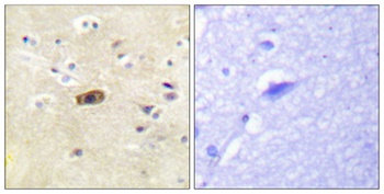 NMDAε1/2 rabbit pAb