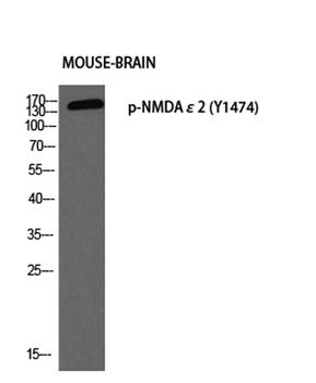 NMDAε2 (phospho Tyr1474) rabbit pAb