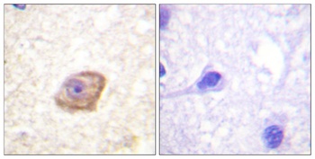 NMDA Epsilon 2 (phospho-Tyr1474) antibody