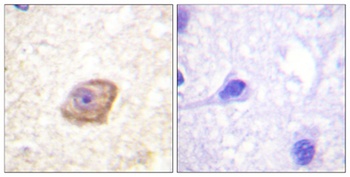 NMDAε2 (phospho Tyr1474) rabbit pAb